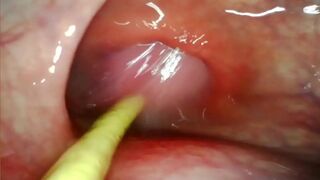 Ultra Rough Anal👌 DP: Deep Camera Vantage as Big Dick🍆 Bursts with Intense Cumshot
